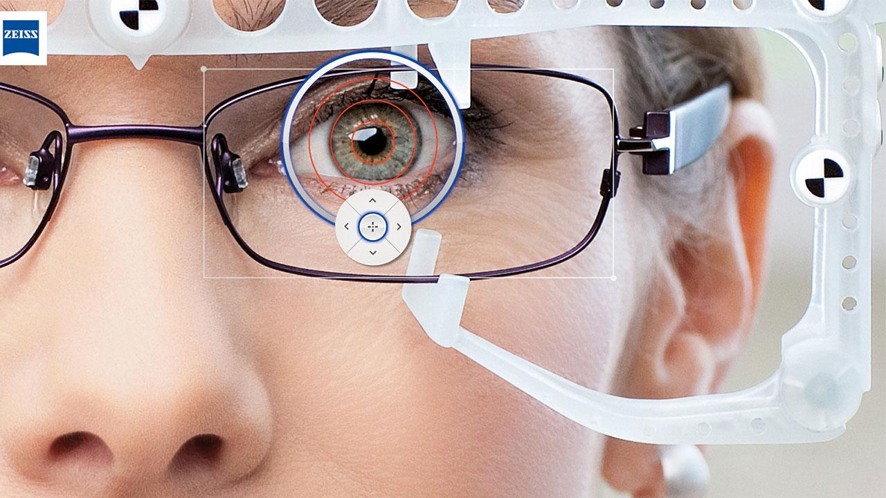 Analysis of right eye